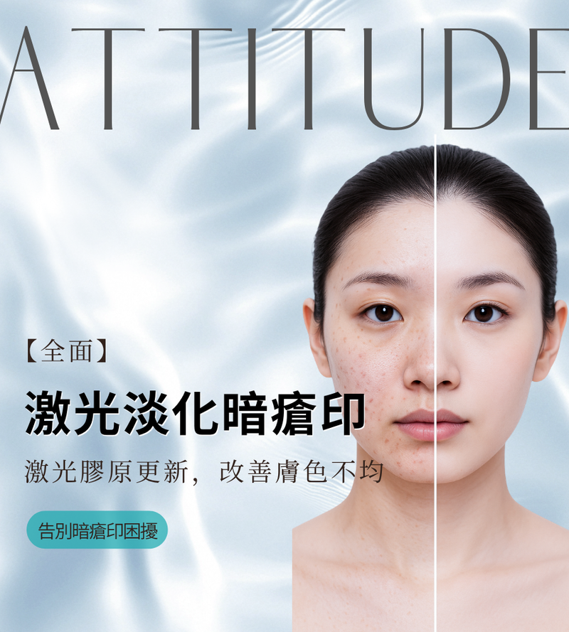 【全面】激光淡印勻膚療程