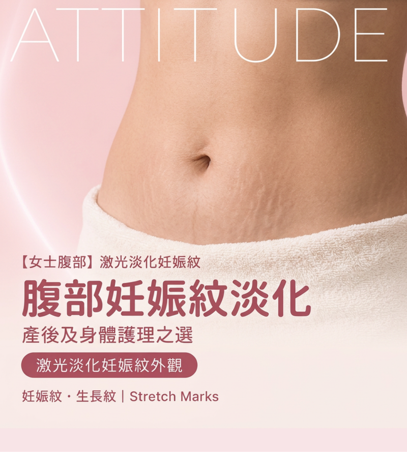 香港女士腹部激光淡化妊娠紋，改善紋路更平滑
