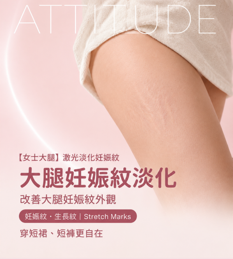 香港女士大腿激光淡化妊娠紋，柔滑腿部減少紋路